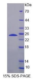 SDS-PAGE (FDXR-15H).jpg
